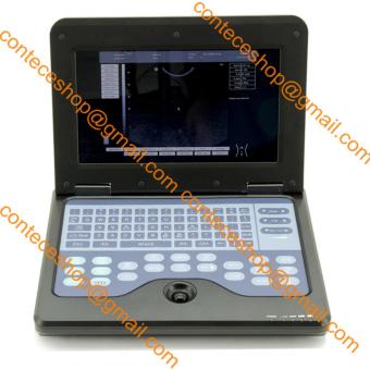 CONTEC Digital Ultrasound Scanner Laptop Machine with 3.5mhz Convex Probe, CE - intl