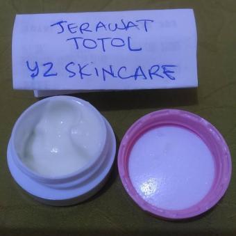 Cream Totol Jerawat YNZ skincare