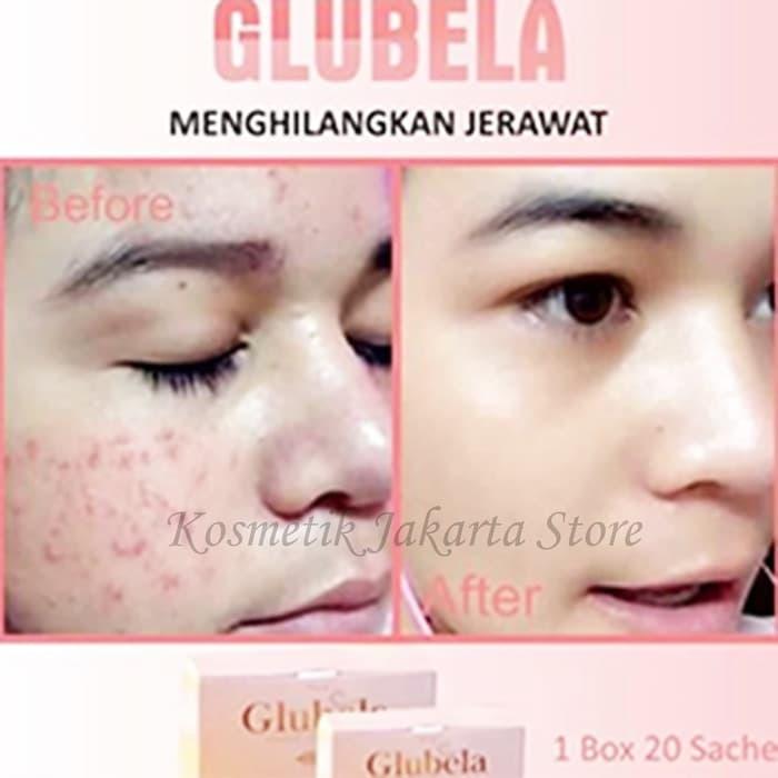 Pemutih Tubuh & Wajah / Penyamar Bekas Luka / Penghilang Flek