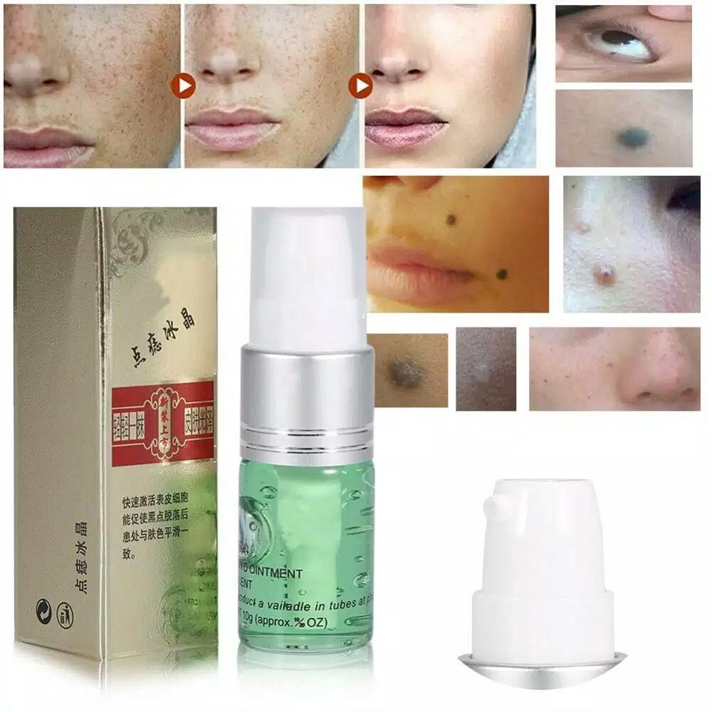 serum anastesi penghilang bekas dark Spot Bintik mole Removal Aftercare Cream
