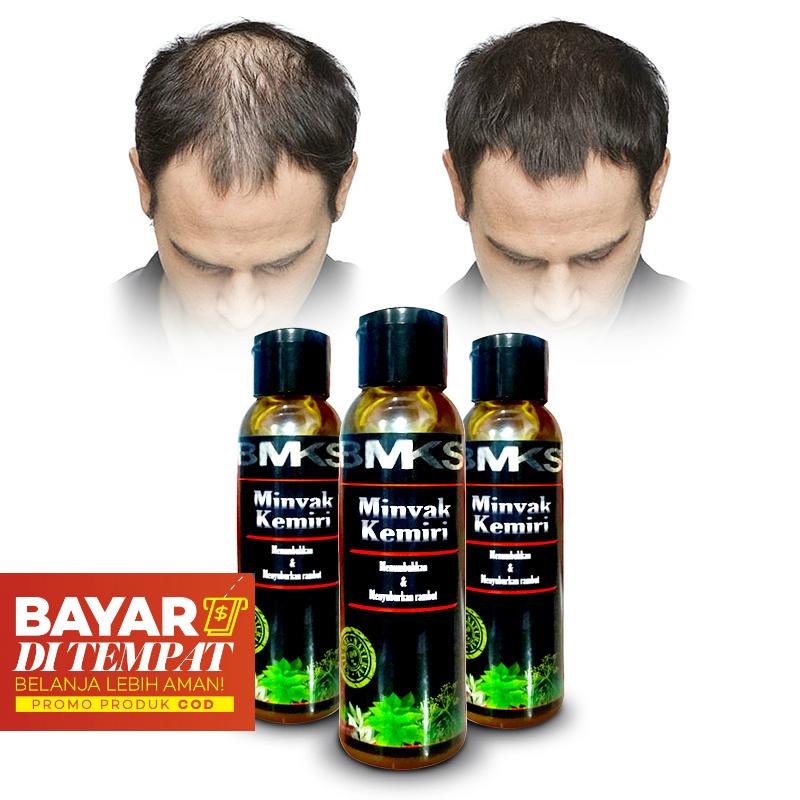 Minyak Kemiri Penumbuh Rambut Original 100% Asli Kemiri - Obat Penumbuh Rambut Aman Untuk Bayi - Obat Penumbuh Rambut Botak - Mencegah dan Mengobati Kebotakan