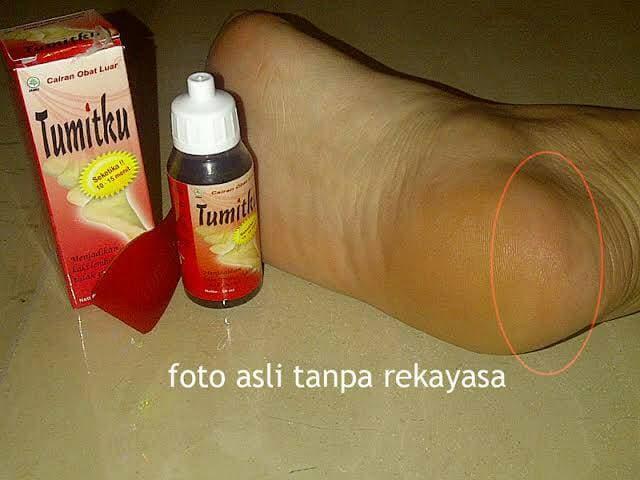 Tumitku Minyak Oles / Obat Kapalan Menghaluskan Tumit Kaki Pecah Pecah / BPOM / Original 100% / Penghalus Tumit Kaki / Alat Penghalus Tumit Pecah Pecah / Obat Penghalus Tumit Kaki Pecah Pecah - Tumitku