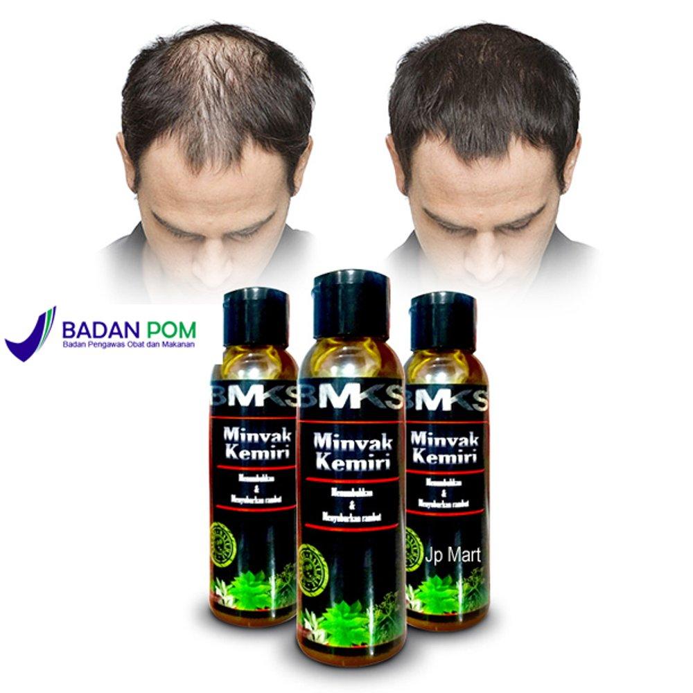 Minyak Kemiri Asli Penumbuh Rambut - Minyak Kemiri BMKS Original 100% BPOM - Minyak Kemiri Untuk Bayi - Vitamin Rambut - Minyak Penumbuh Rambut Cepat - Penyubur Rambut - Obat Penumbuh Rambut Botak