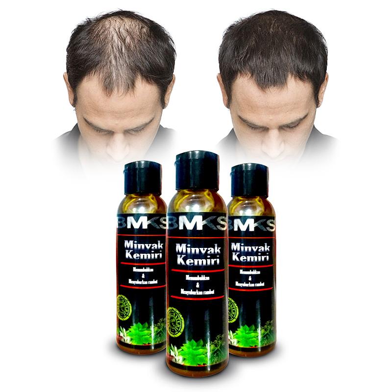 BMKS Minyak Kemiri Penyubur dan Penghitam Rambut BPOM - 100ml