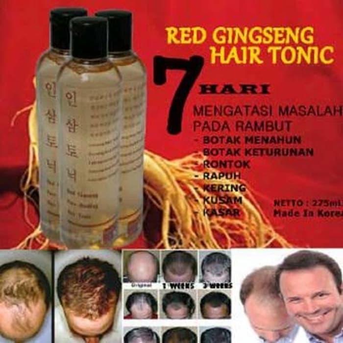 Red Ginseng Hair Tonic 100% ASLI Original Korea - Vitamin Rambut Rontok Botak - Red Ginseng Hair Tonic - Korean Red Ginseng - Obat Penumbuh Rambut Botak - Obat Penyubur Rambut - Penumbuh Rambut Cepat - Penumbuh Rambut Botak - Perawatan Rambut Rontok