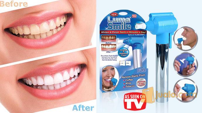 HOT SALE - ASLI BUKAN BARANG KW !! Pemutih Gigi Luma Smile Teeth Polish Whitener Pembersih Plak Karang, Menghilangkan Warna Kuning pada Gigi, Natural, aman dan Sudah Terbukti Hasilnya