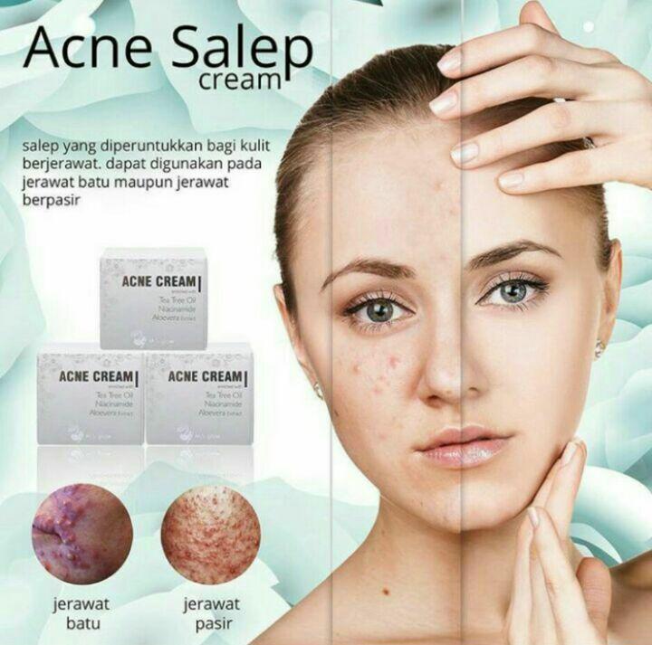 Salep acne ms glow by cantik skincare original bpom