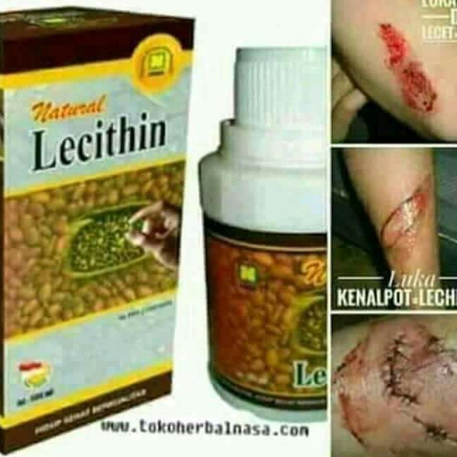 LECITHYN CAIR OBAT SAPU JAGAT NASA MENGATASI KOMEDO DAN SEGALA MACAM PENYAKIT
