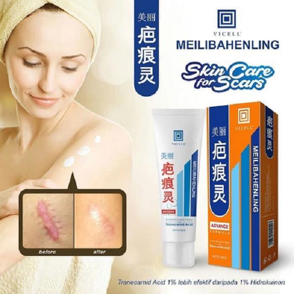 Salep Meilibahenling Pemudar Dan Penghilang Bekas Luka - 1pcs