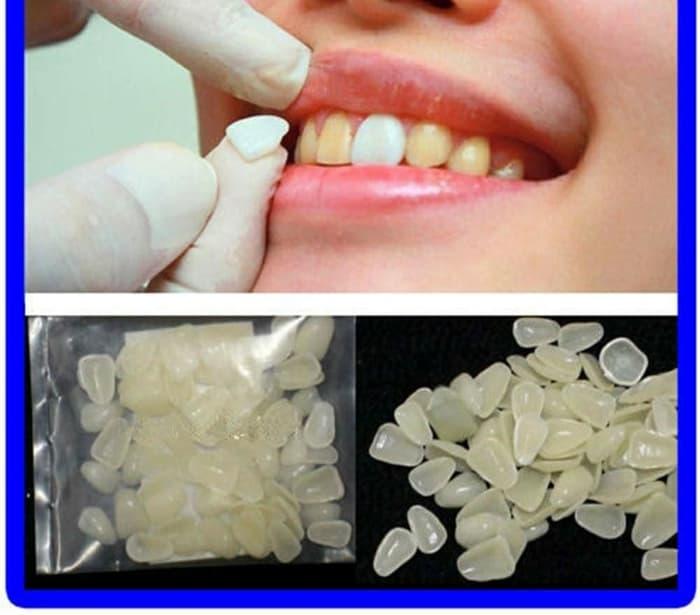 PROMO Veneer Gigi Palsu Putih 70 pcs Pemutih Gigi Estetika Gigi Bersih - dpCiSgdC
