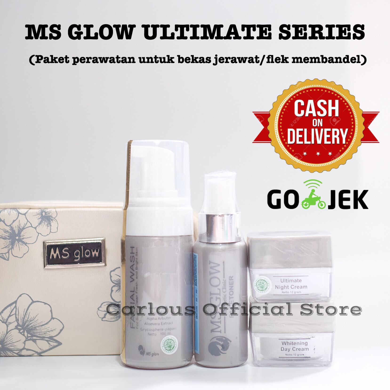 Carlous Msglow Ultimate Series Toner Step 1/Toner Klinik 100% Original / MS Glow Paket Perawatan Wajah Bekas Noda Flek & Jerawat