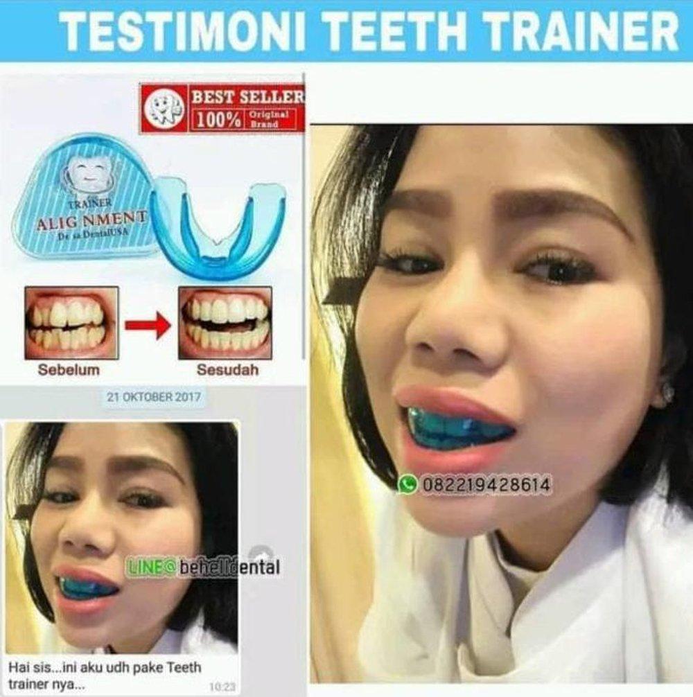 PROMO ortho trainer . alat perapih perapi gigi . behel pelurus gigi . teeth STOK TERBATAs di lapak bubushop kinkenshop12
