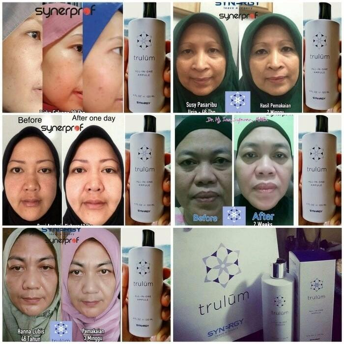 Tester Trulum Skincare 5in1 Ampule 5ml ASLI dan RESMI Synergi 100%