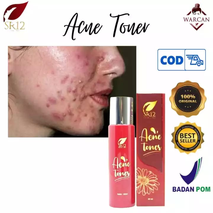 Lazada Indonesia - OBAT JERAWAT/ACNE TONER SR12/MENGHEMPAS JERAWAT/MEMUDARKAN BEKAS JERAWAT/MENGURANGI MINYAK BERLEBIH/MENCERAHKAN WAJAH