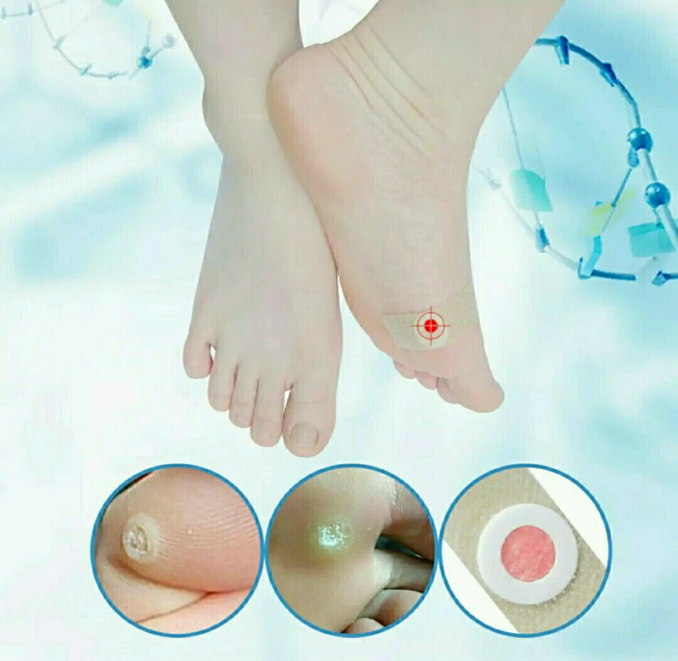 Plester Koyo Penghapus Kutil Menghilangkan Mata Ikan 1 Pcs Lazada Indonesia