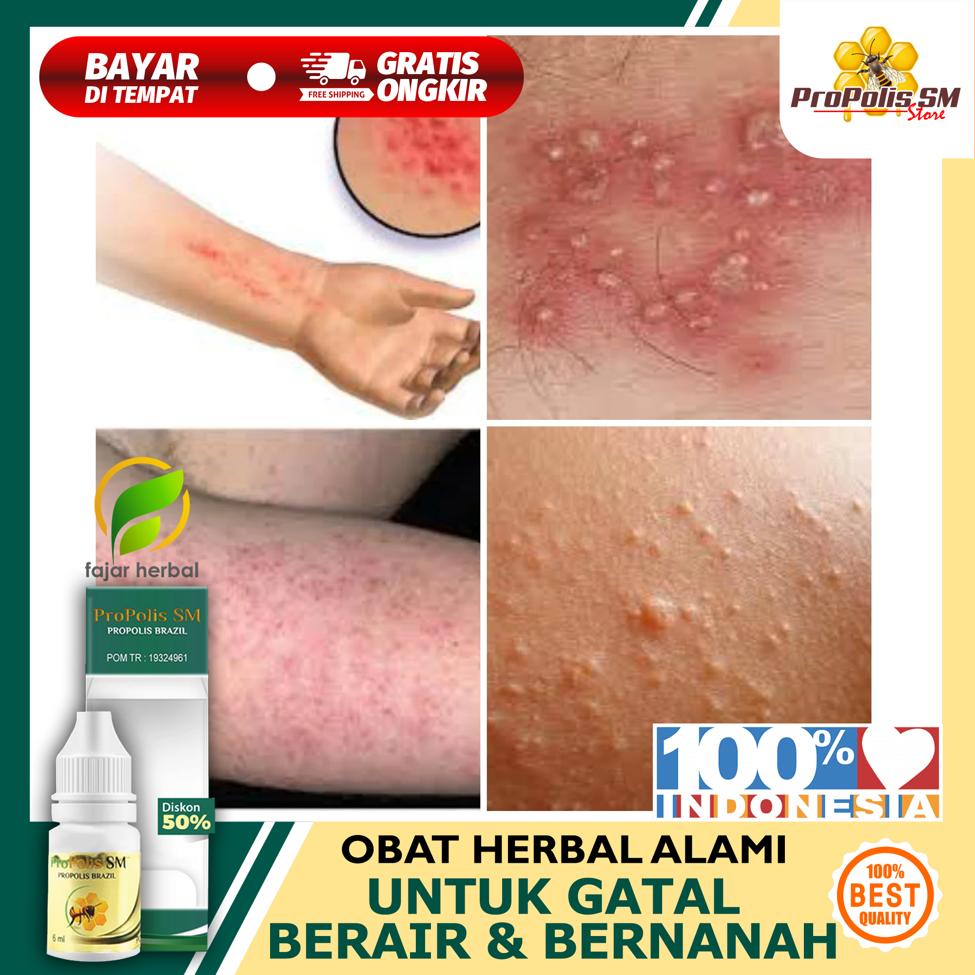 Jual Obat Bintik Berair Kulit Gatal Terbaru Lazada Co Id