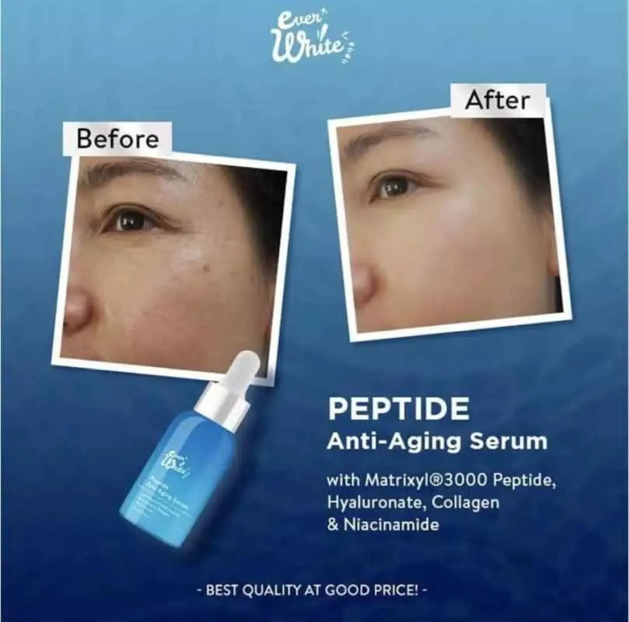 everwhite peptide serum