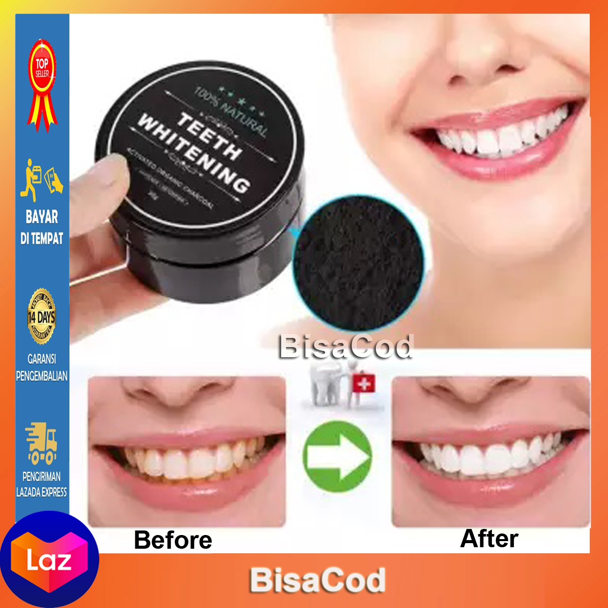 molr teeth whitening