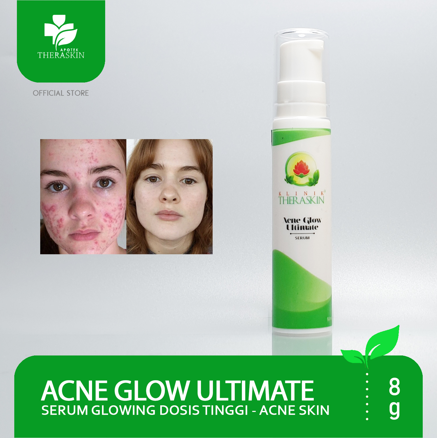 serum acne theraskin