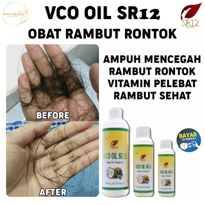 Lazada Indonesia - TERLARIS !! MINYAK RAMBUT RONTOK/OBAT KETOMBE/ PELEBAT RAMBUT AMPUH/ VCO OIL SR12 BPOM 100% ORIGINALMERAWAT RAMBUT RUSAK/RAMBUT MUDAH DIATUR/VCO 60ML