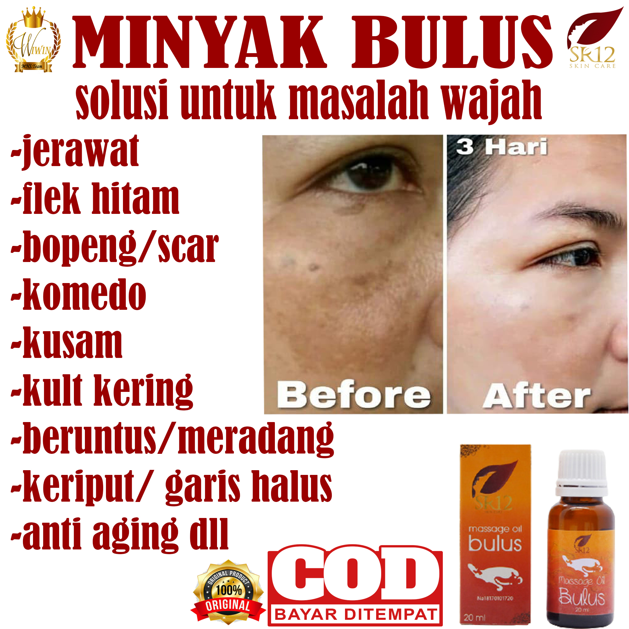 Lazada Indonesia - MINYAK FLEK HITAM/MENGHEMPAS FLEK HITAM/MENGHEMPAS BEKAS JERAWAT/MELEMBABKAN KULIT/MEMBUAT KULIT CERAH/MENGATASI KULIT GATAL-GATAL