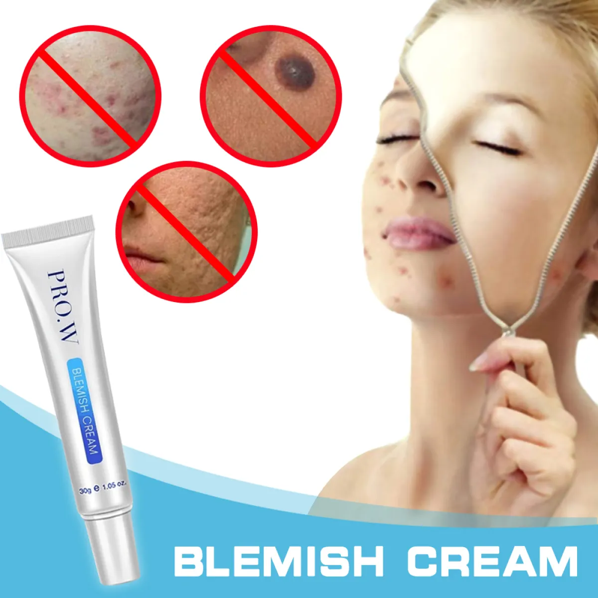 blemishes remove cream