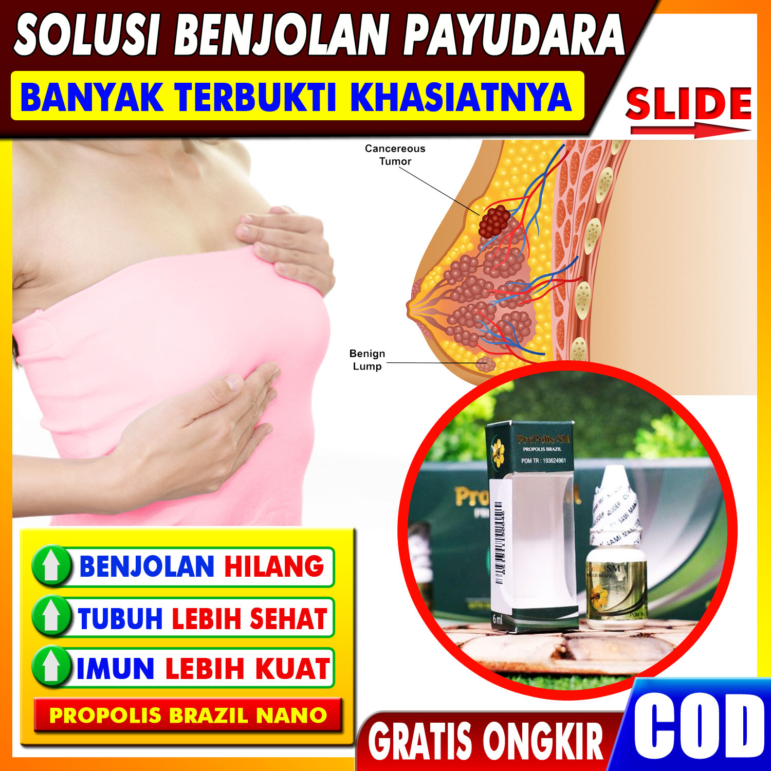 Obat Benjolan Di Payudara Sebelah Kanan Kiri Penghilang Benjolan Payudara Alami Tanpa Efek Samping Aman Untuk Ibu Hamil Dan Menyusui Propoli Sm Propolis Brazil Asli Nanotechnology 100 Asli Original Premium