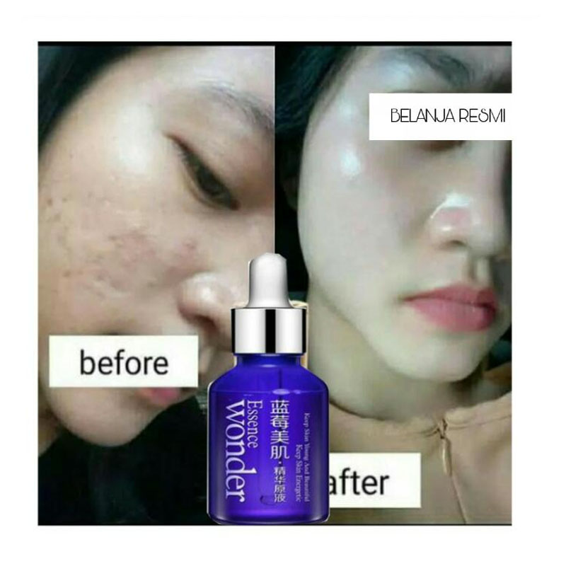 serum essence wonder