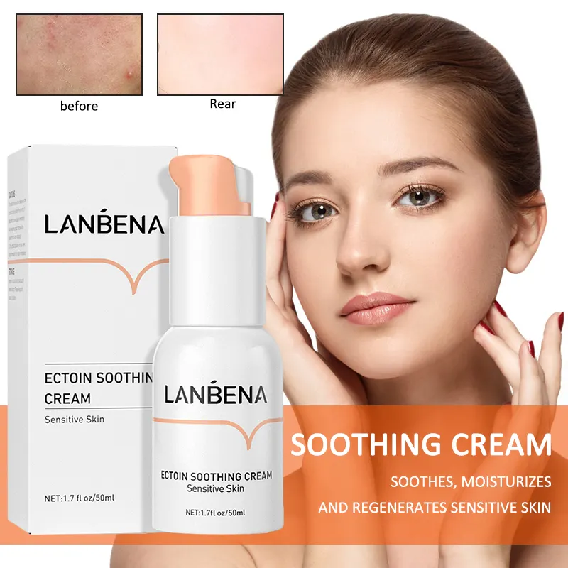 acne soothing cream