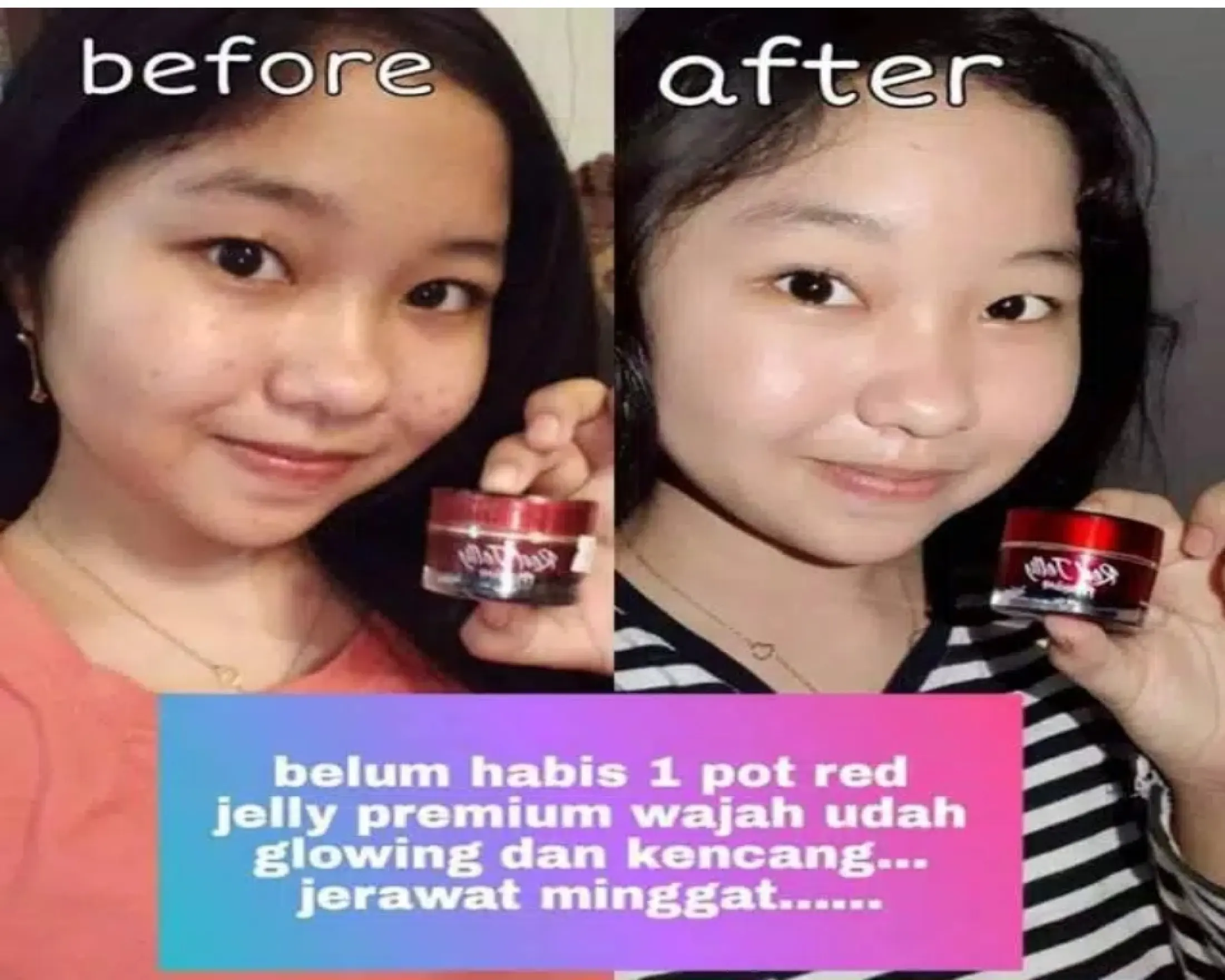 Bayar Ditempat Red Jelly Premium Skin Booster Rk Glow Original Aman Halal Dan Bpom Membuat Wajah Putih Glowing Dan Meremajakan Kulit Wajah 100 Original Berid Card Lazada Indonesia
